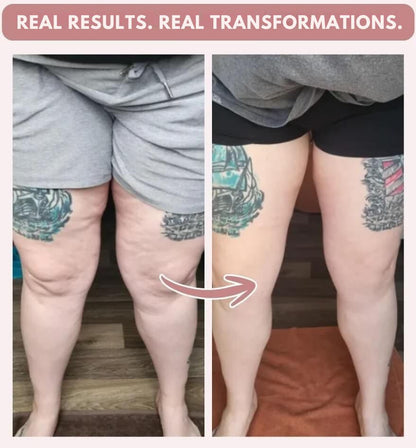 3D Anti cellulite Legging