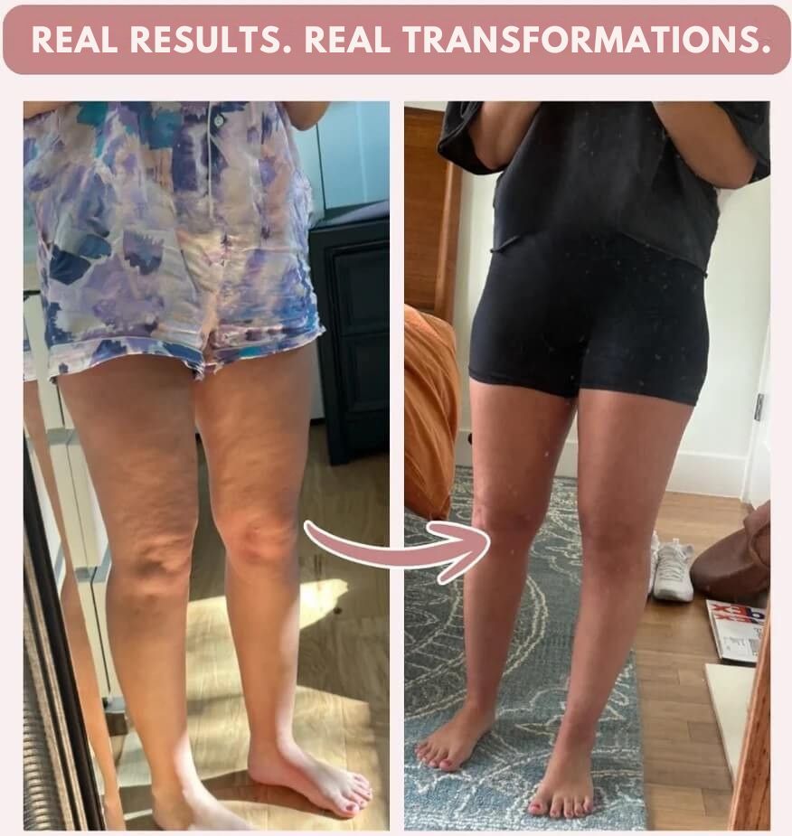 3D Anti cellulite Legging